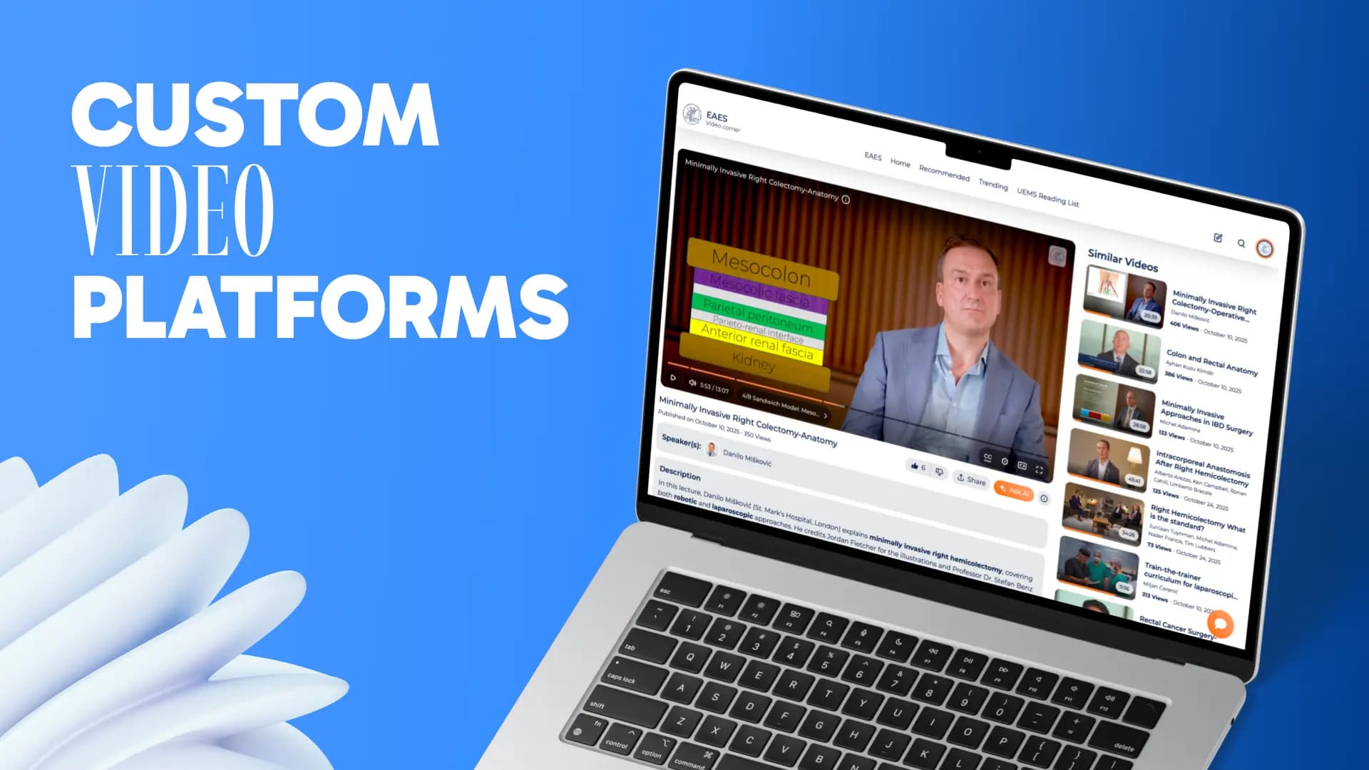 Custom Video Platforms Banner